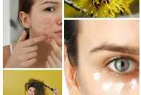 32 Astonishing Secrets of Witch Hazel for Beauty Health Home and Pet Care