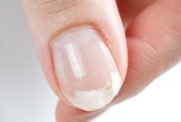 Instant Nail Repair: Quick DIY Solutions for Cracks and Breaks