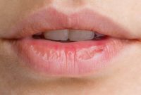 Homemade Solutions for Soft, Healthy Lips