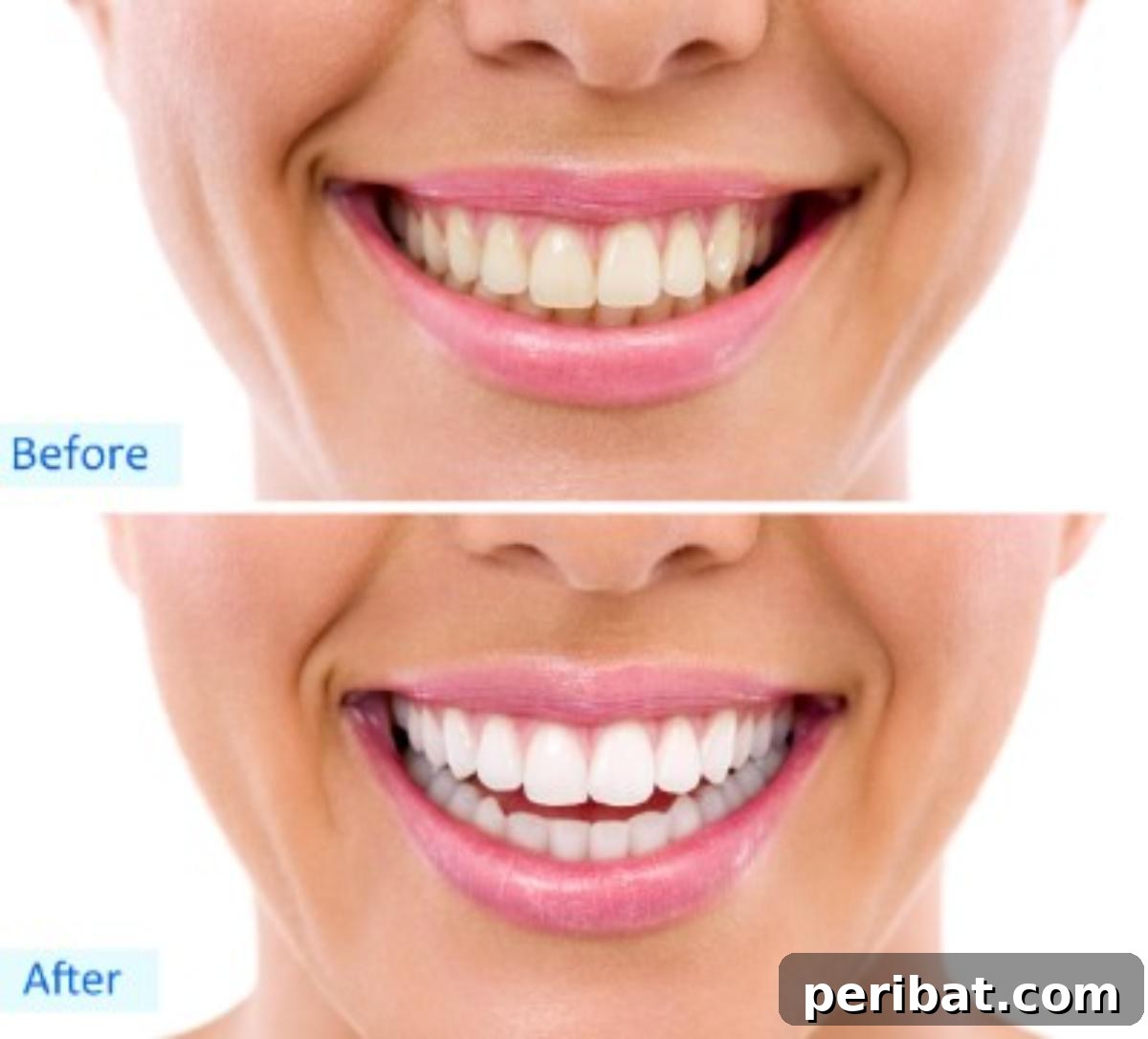 51 Genius Hydrogen Peroxide Hacks 16 Teeth whitening before and after