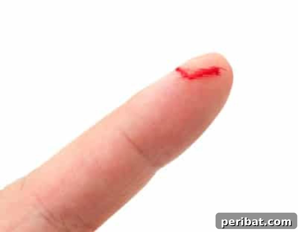 51 Genius Hydrogen Peroxide Hacks 3 Wounded finger