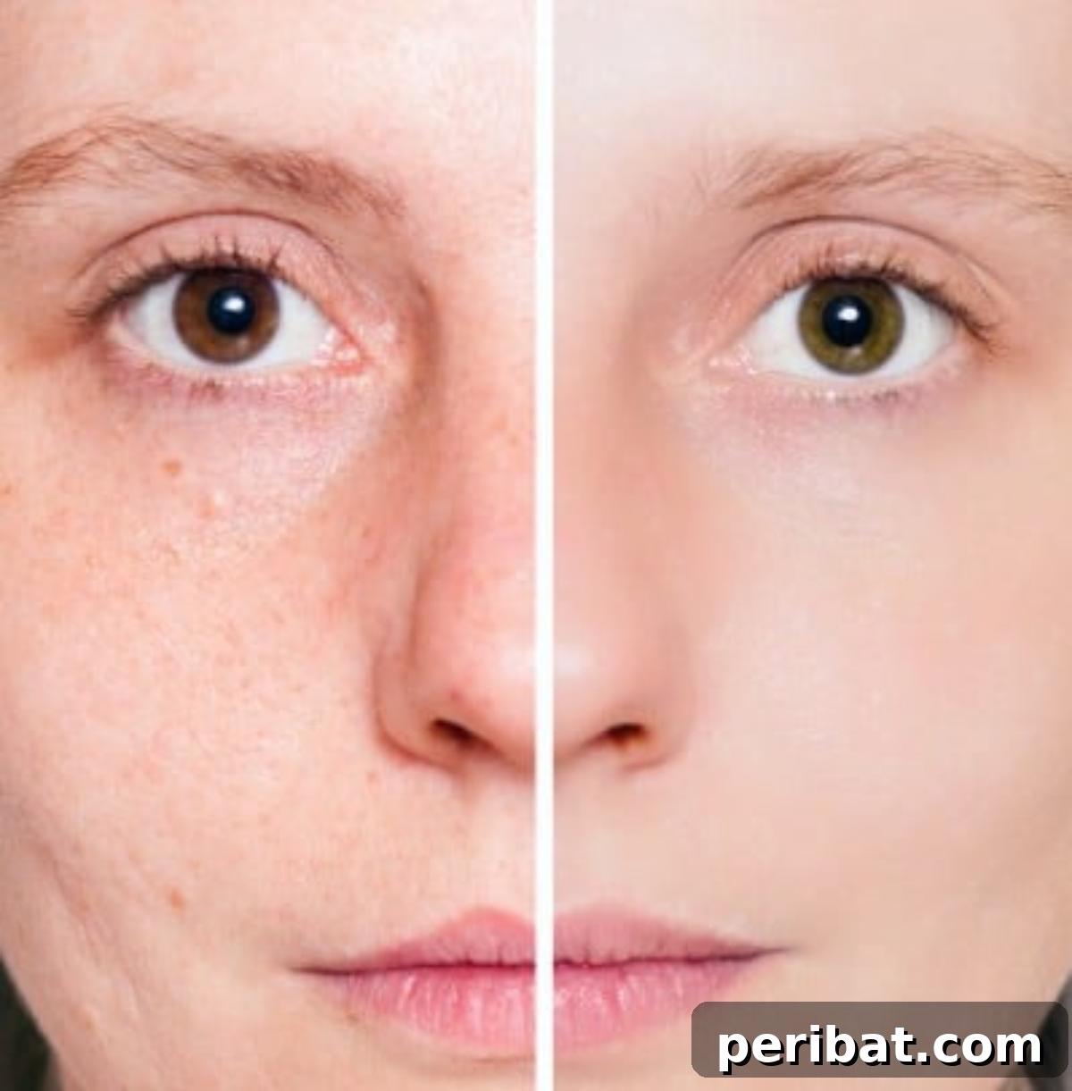 51 Genius Hydrogen Peroxide Hacks 4 Acne cleaning - before and after