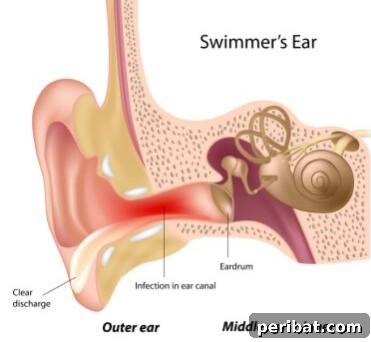 51 Genius Hydrogen Peroxide Hacks 9 Swimmer's ear