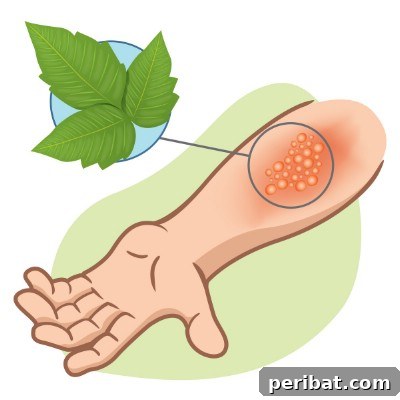 32 Astonishing Secrets of Witch Hazel for Beauty Health Home and Pet Care 21 Relieve poison ivy and poison oak.