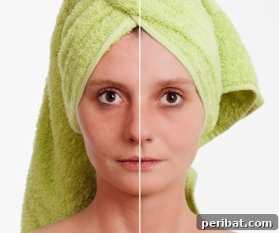 32 Astonishing Secrets of Witch Hazel for Beauty Health Home and Pet Care 6 Shrink your pores.