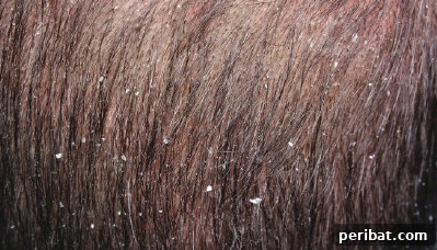 32 Astonishing Secrets of Witch Hazel for Beauty Health Home and Pet Care 7 Get rid of dandruff.