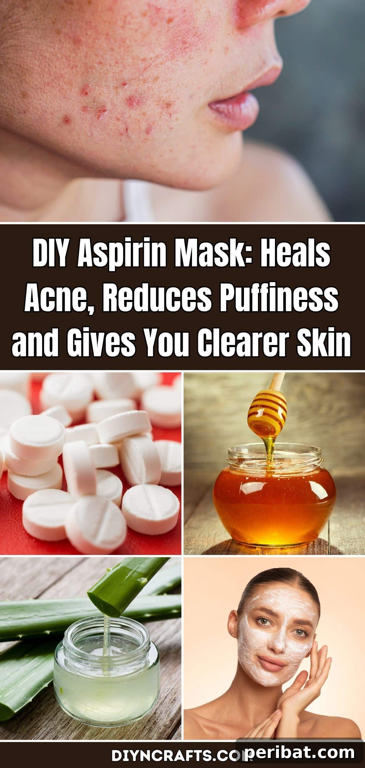 DIY Aspirin Mask: Your Secret to Clear, Calm, and Radiant Skin 2 DIY Aspirin Mask: Heals Acne, Reduces Puffiness and Gives You Clearer Skin pinterest image