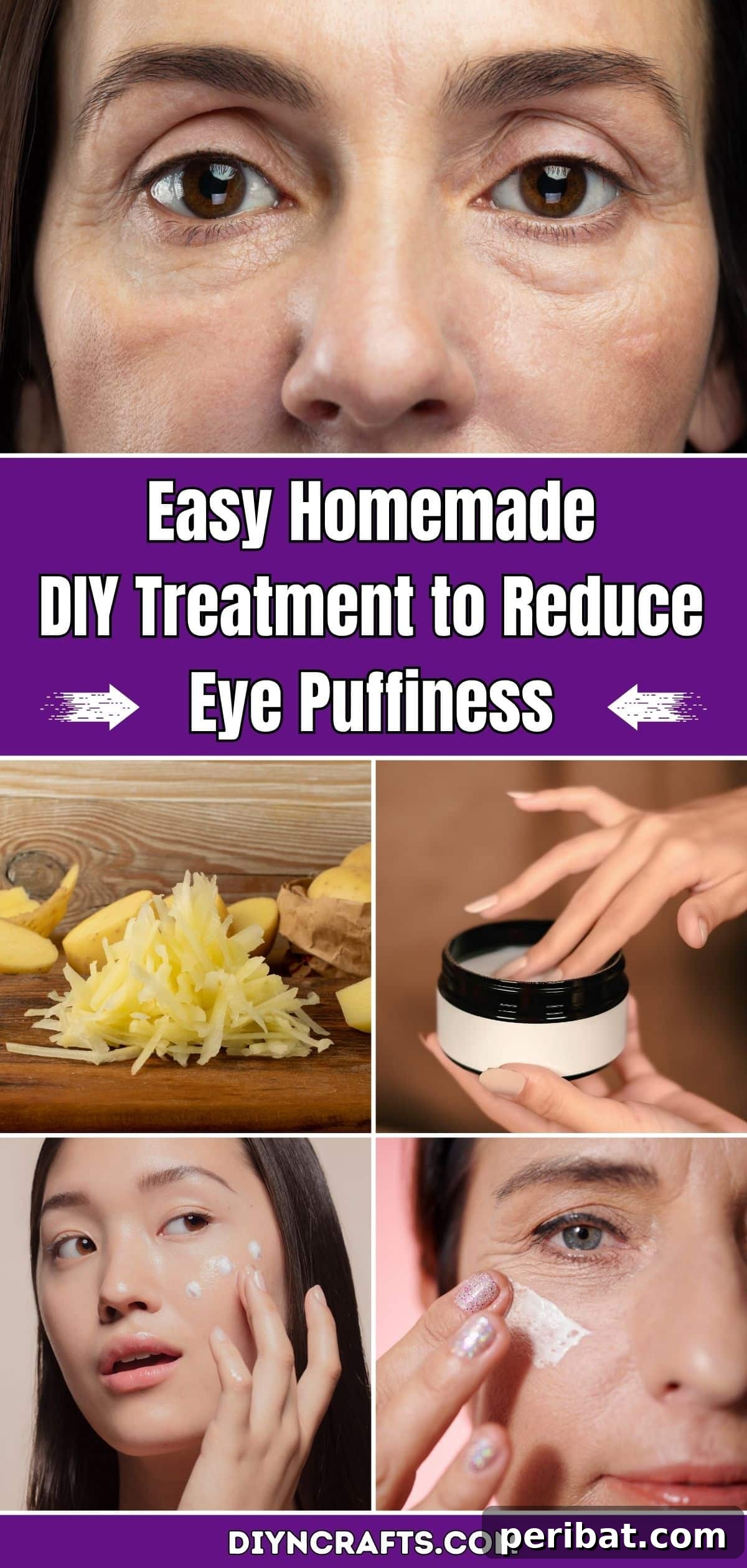 Quick DIY Fixes for Puffy Under-Eyes 2 Easy Homemade DIY Treatment to Reduce Eye Puffiness pinterest image
