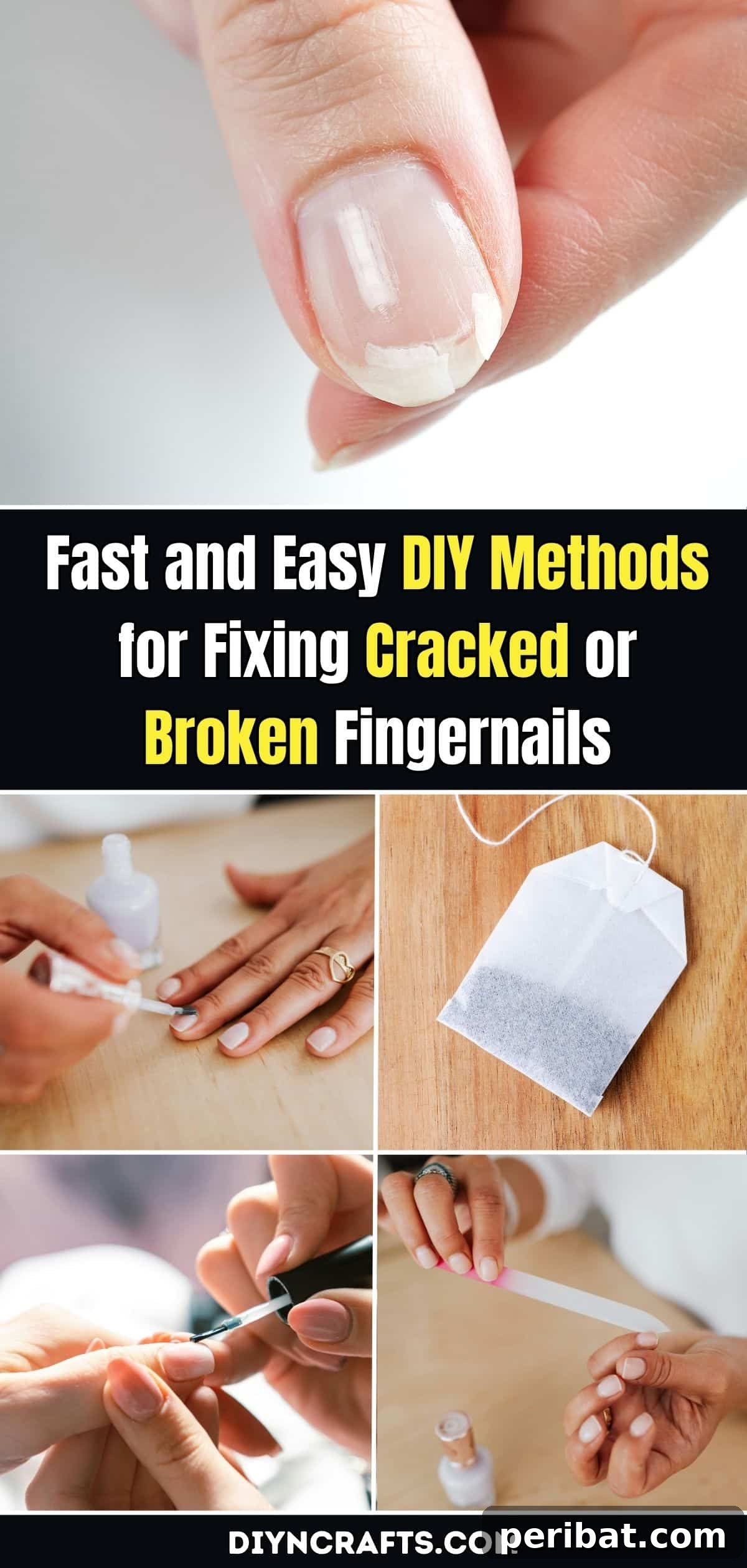 Instant Nail Repair: Quick DIY Solutions for Cracks and Breaks 2 Fast and Easy DIY Methods for Fixing Cracked or Broken Fingernails pinterest image