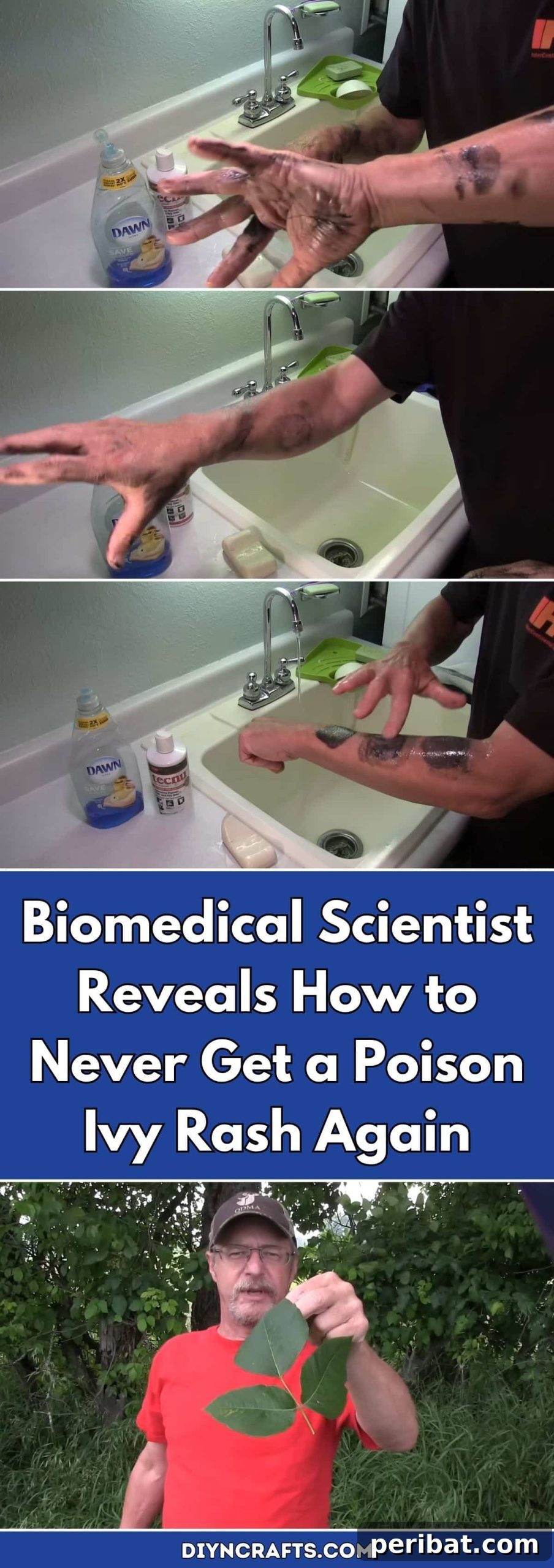 Biomedical Scientist Reveals How to Never Get a Poison Ivy Rash Again pinterest image
