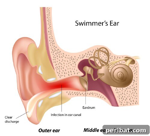 Çok Amaçlı Mucize: İzopropil Alkolün 56 Akıllara Zarar Kullanım Alanı 7 Prevent swimmer’s ear.