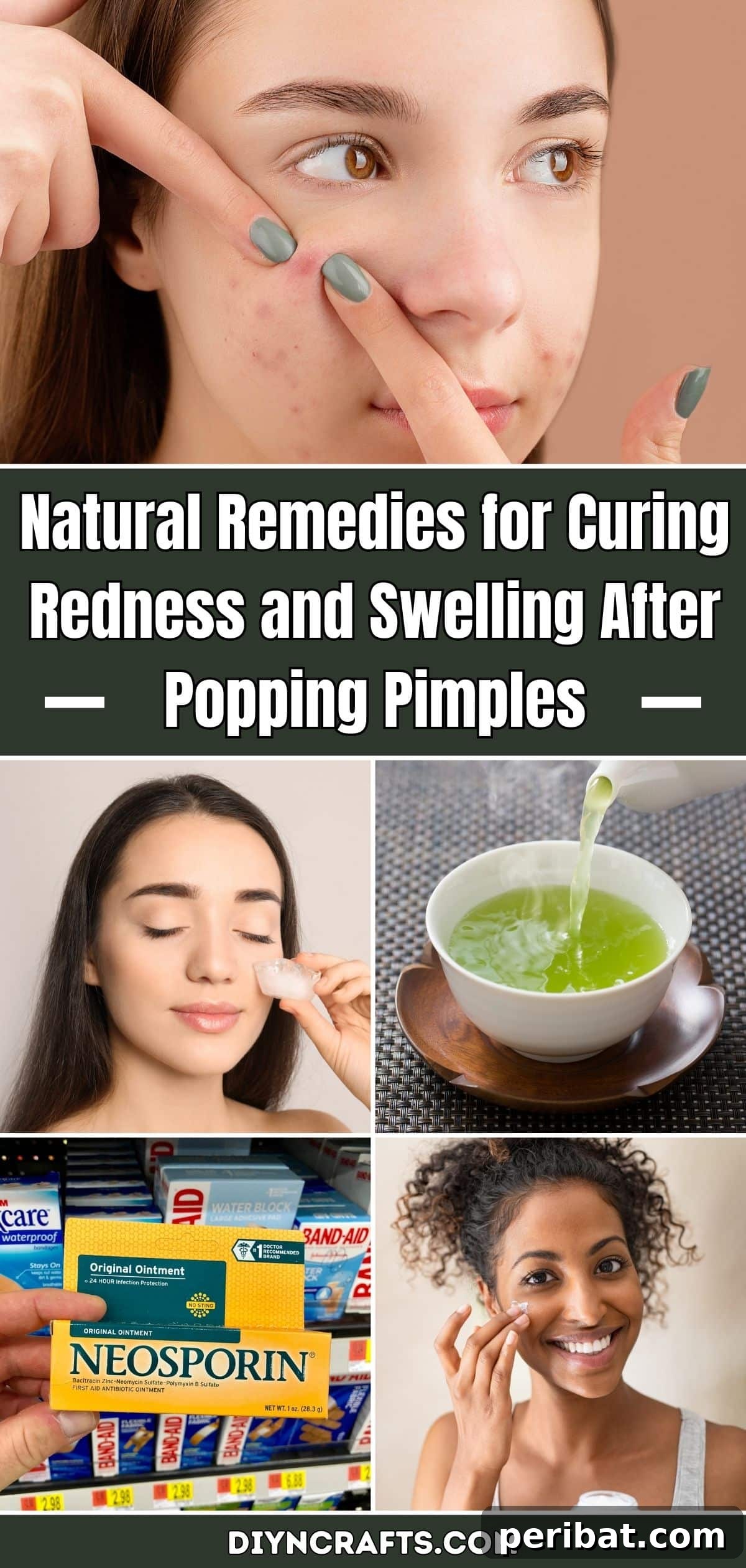 Soothe and Heal: Natural Ways to Calm Post-Pimple Redness and Swelling 2 Natural Remedies for Curing Redness and Swelling After Popping Pimples pinterest image