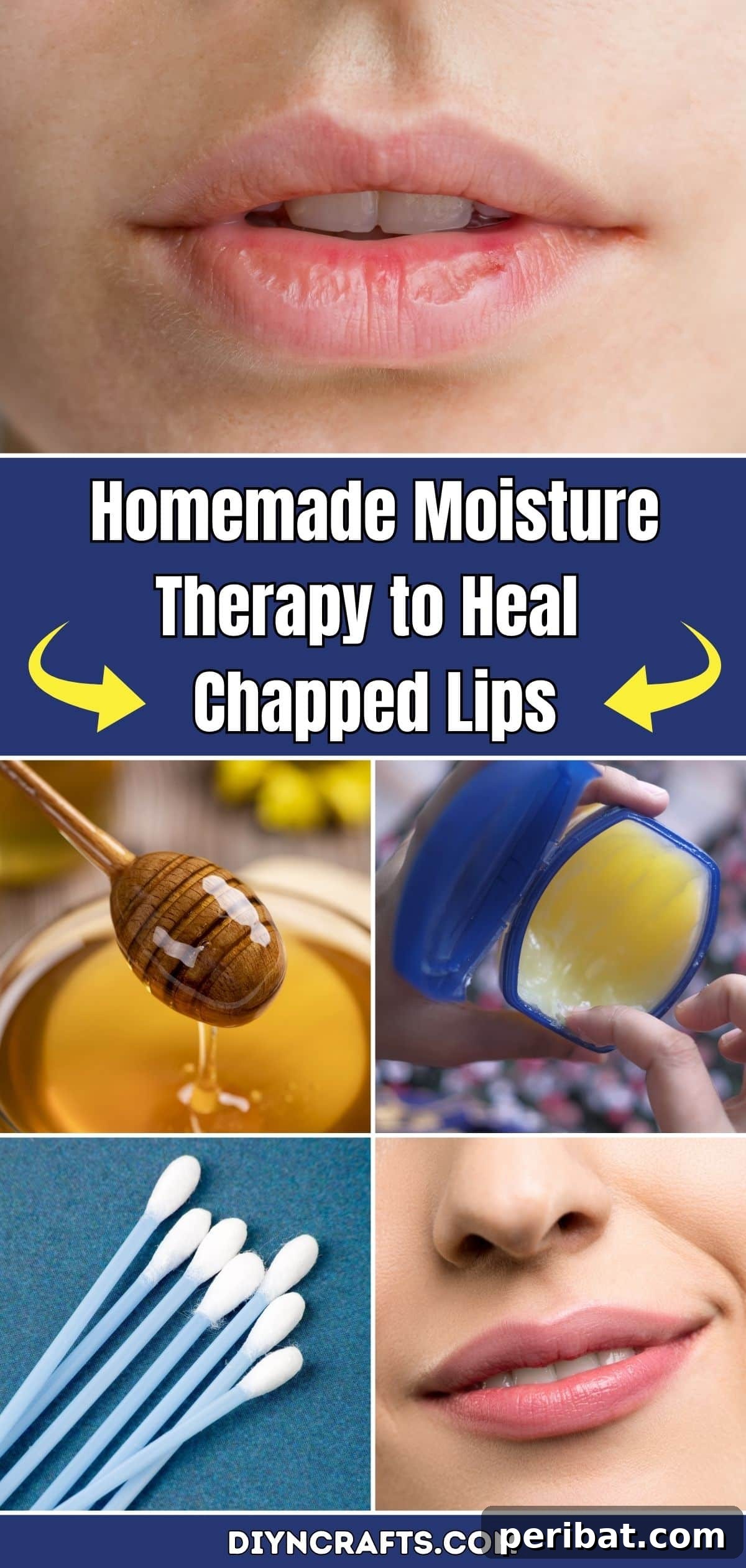 Homemade Solutions for Soft, Healthy Lips 2 Homemade Moisture Therapy to Heal Chapped Lips pinterest image