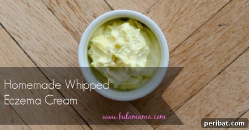 25 Coconut Oil Hacks to Replace All Your Health and Beauty Essentials 14 Natural Eczema Cream with Coconut Oil