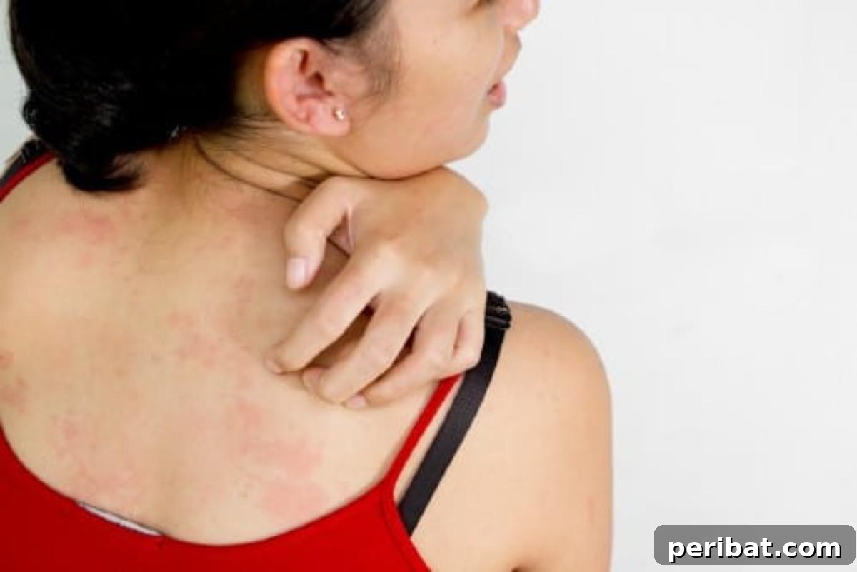 Woman scratching her itchy back, symbolizing relief from minor skin irritations
