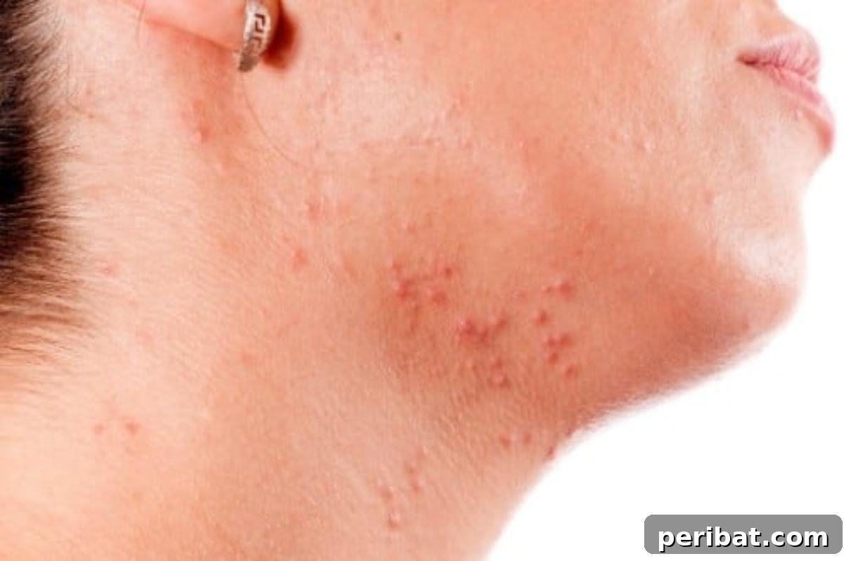 Face with acne, highlighting castor oil as a natural treatment