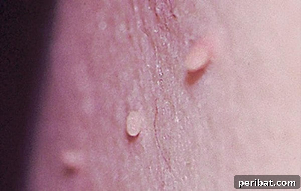 Skin with warts, illustrating targeted treatment with castor oil