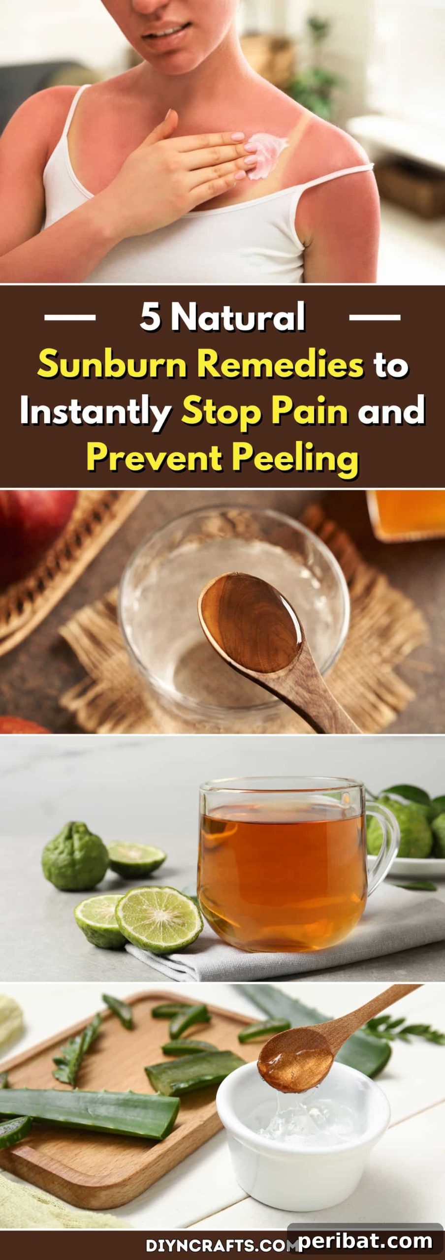 Sunburn Savior: 5 Natural Remedies for Instant Pain Relief and Peel-Free Skin 2 Natural Sunburn Remedies to Soothe Pain and Prevent Peeling