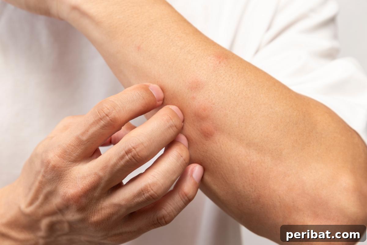 Beyond the Bubbles – 20 Brilliant Alka-Seltzer Hacks 17 Insect bites.